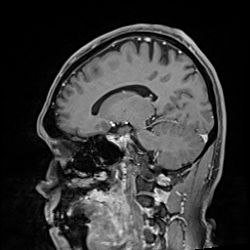 Click on the Serie image to view the images of VILLANUEVA, WILLIAM A.